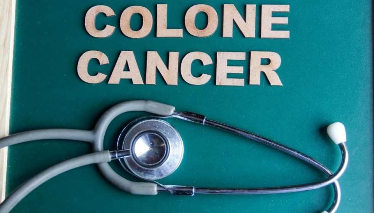 how to prevent colon cancer