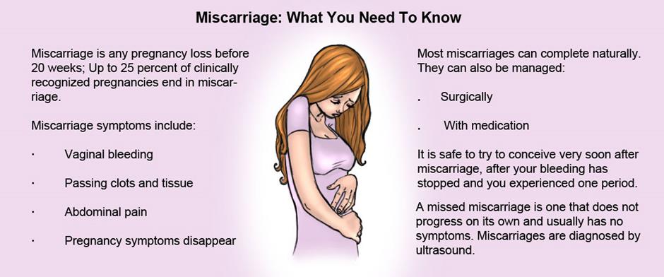 Miscarriages are classified as