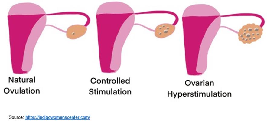 IVF