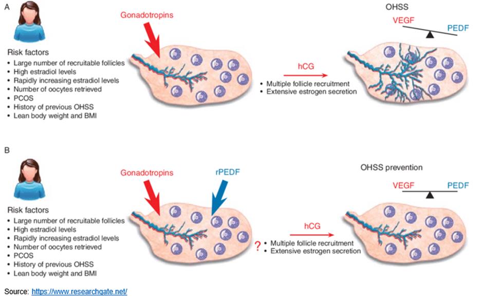 complications likely to arise from OHSS